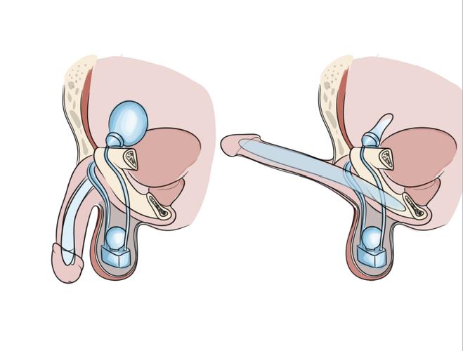 Chlorhexidine Powder CAS 55-56-1 Applications | Shaanxi BLOOM Tech Co., Ltd Chlorhexidine Powder CAS 55-56-1 Applications | Shaanxi BLOOM Tech Co., Ltd