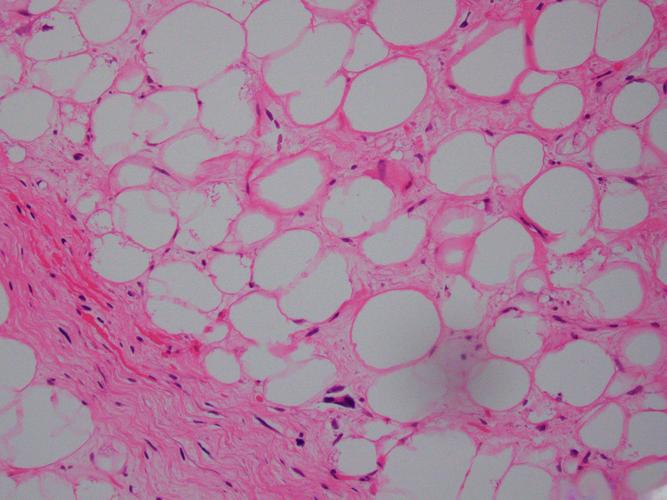 hGH 176-191 buy | Shaanxi BLOOM Tech Co., Ltd