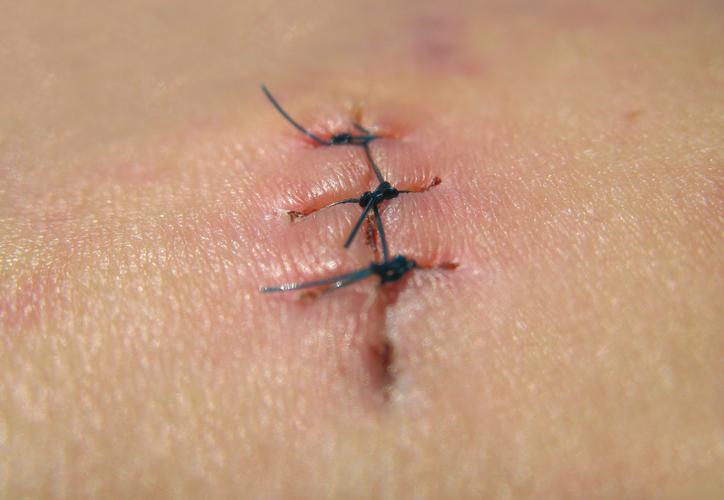 Retatrutide buy | Shaanxi BLOOM Tech Co., Ltd