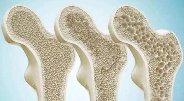 Teriparatide price | Shaanxi BLOOM Tech Co., Ltd Teriparatide price | Shaanxi BLOOM Tech Co., Ltd