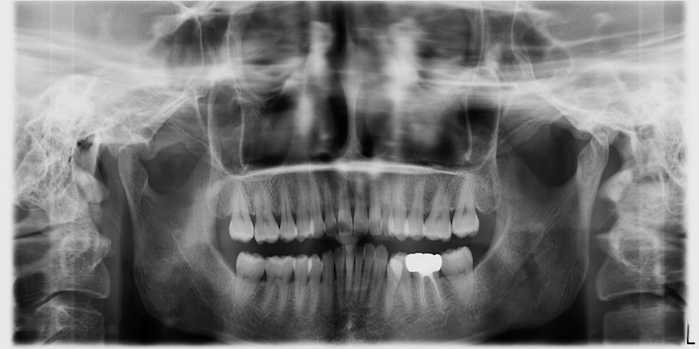 Calcitonin salmon price | Shaanxi BLOOM Tech Co., Ltd Calcitonin salmon price | Shaanxi BLOOM Tech Co., Ltd