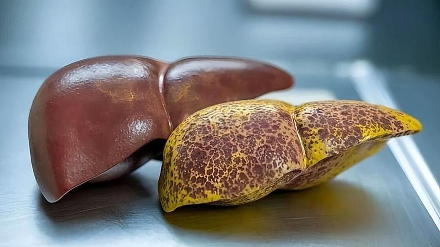 Pramlintide uses | Shaanxi BLOOM Tech Co., Ltd