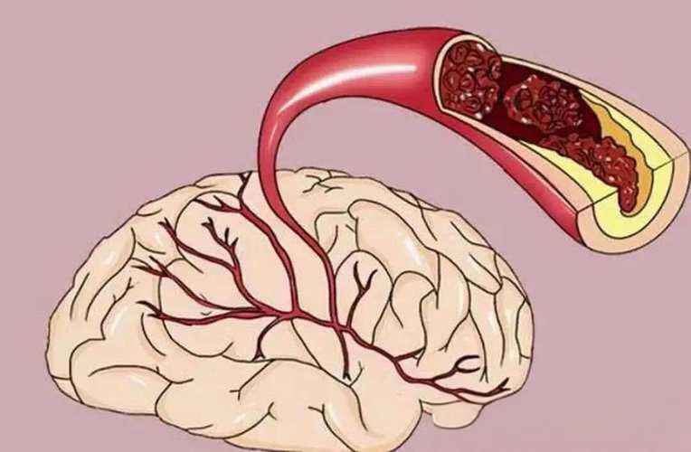 Pinealon neuroprotective mechanisms | Shaanxi BLOOM Tech Co., Ltd Pinealon neuroprotective mechanisms | Shaanxi BLOOM Tech Co., Ltd