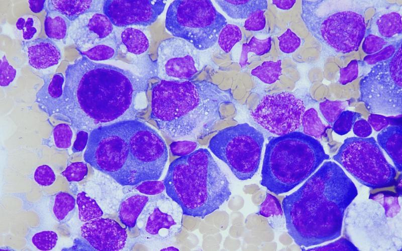 Bioglutide Cellular Receptor Sensitivity Restoration | Shaanxi BLOOM Tech Co., Ltd