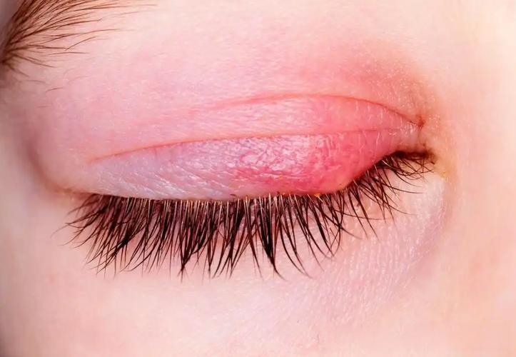 Loratadine Allergic Diseases | Shaanxi BLOOM Tech Co., Ltd Loratadine Allergic Diseases | Shaanxi BLOOM Tech Co., Ltd