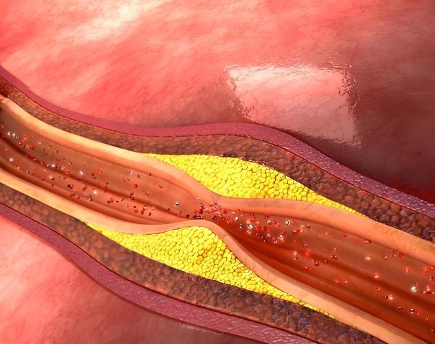Riboflavin Sodium Phosphate Clinical Manifestations | Shaanxi BLOOM Tech Co., Ltd