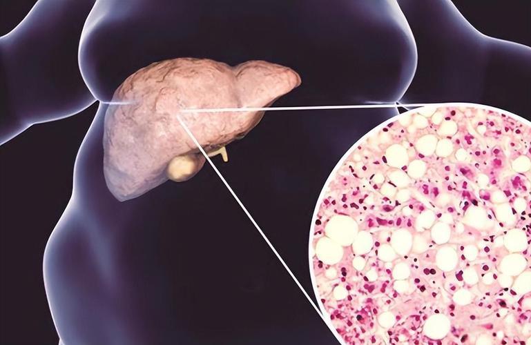 Bioglutide NA-931 Reducing Systemic Inflammation | Shaanxi BLOOM Tech Co., Ltd Bioglutide NA-931 Reducing Systemic Inflammation | Shaanxi BLOOM Tech Co., Ltd
